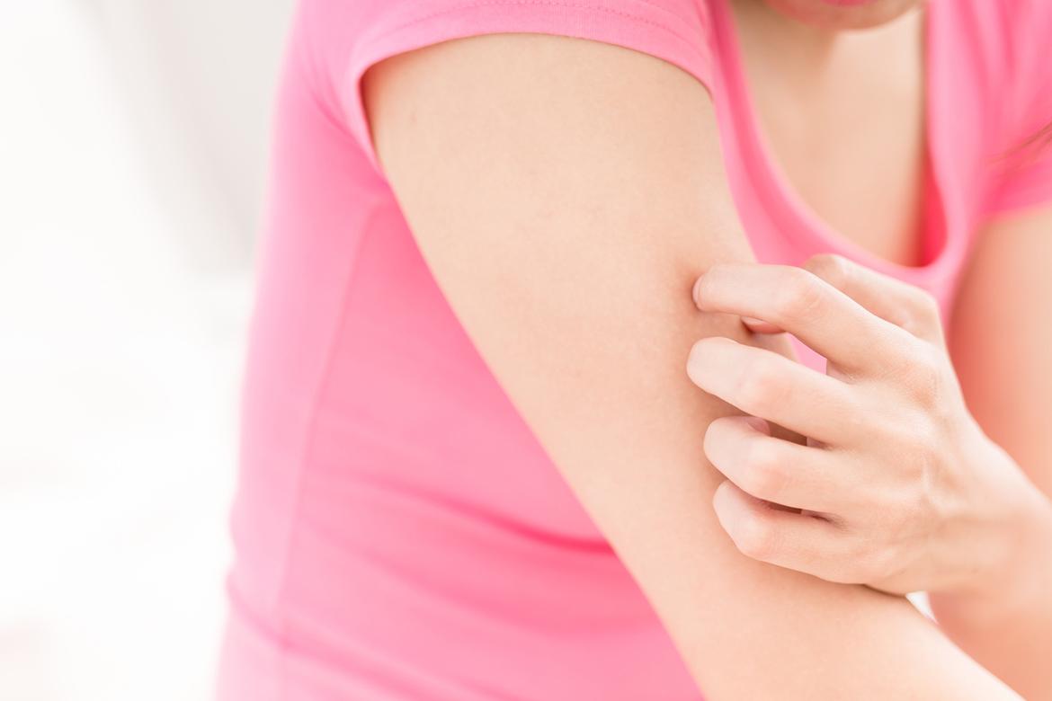 What to Do when an Allergic Reaction Occurs